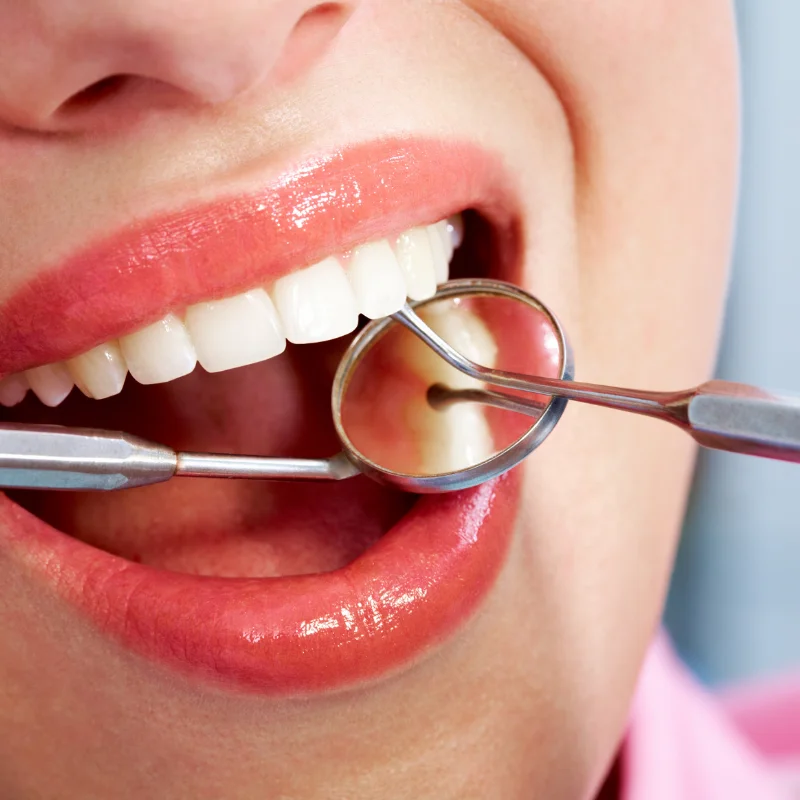 Comparing dental restoration options