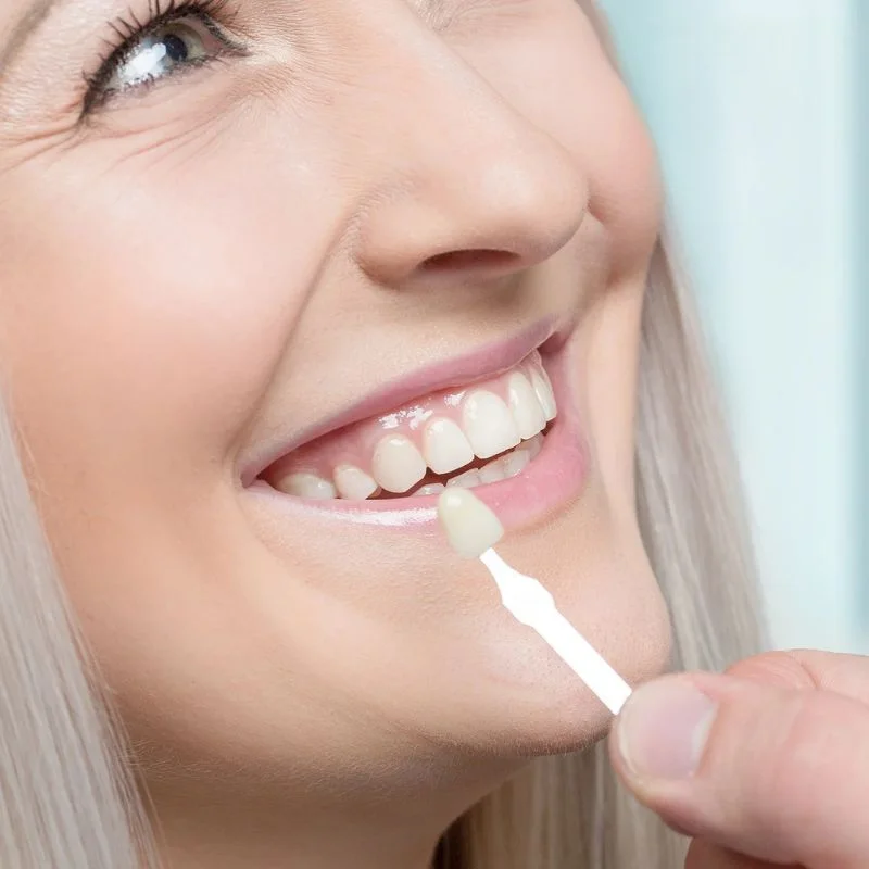 Dentist matching dental veneer shade to patient's teeth during cosmetic dentistry consultation at Fairmont Dental Centre