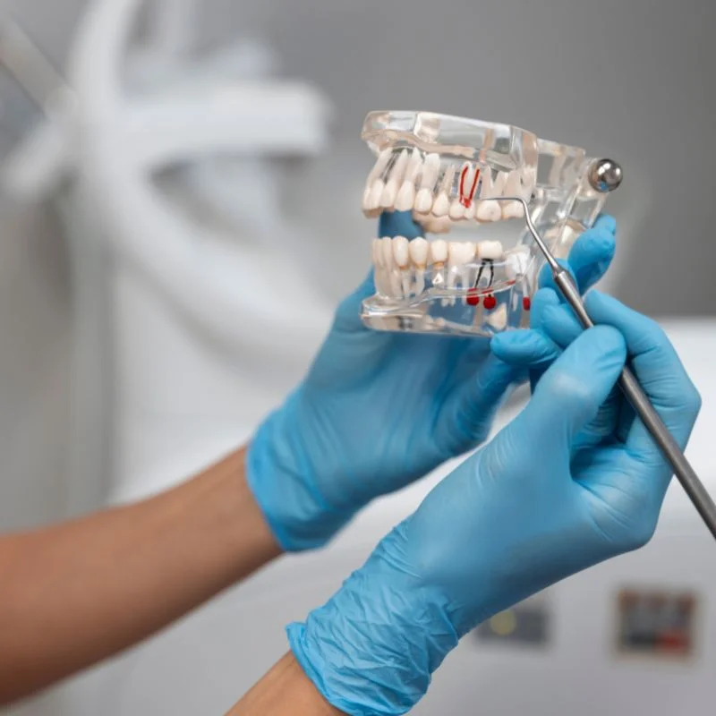 Dentist holding tooth model explaining endodontic treatment and root canal procedure at Fairmont Dental Centre in London Ontario